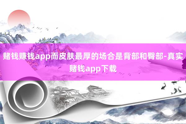赌钱赚钱app而皮肤最厚的场合是背部和臀部-真实赌钱app下载