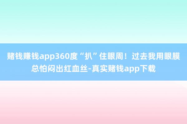 赌钱赚钱app360度“扒”住眼周！过去我用眼膜总怕闷出红血丝-真实赌钱app下载